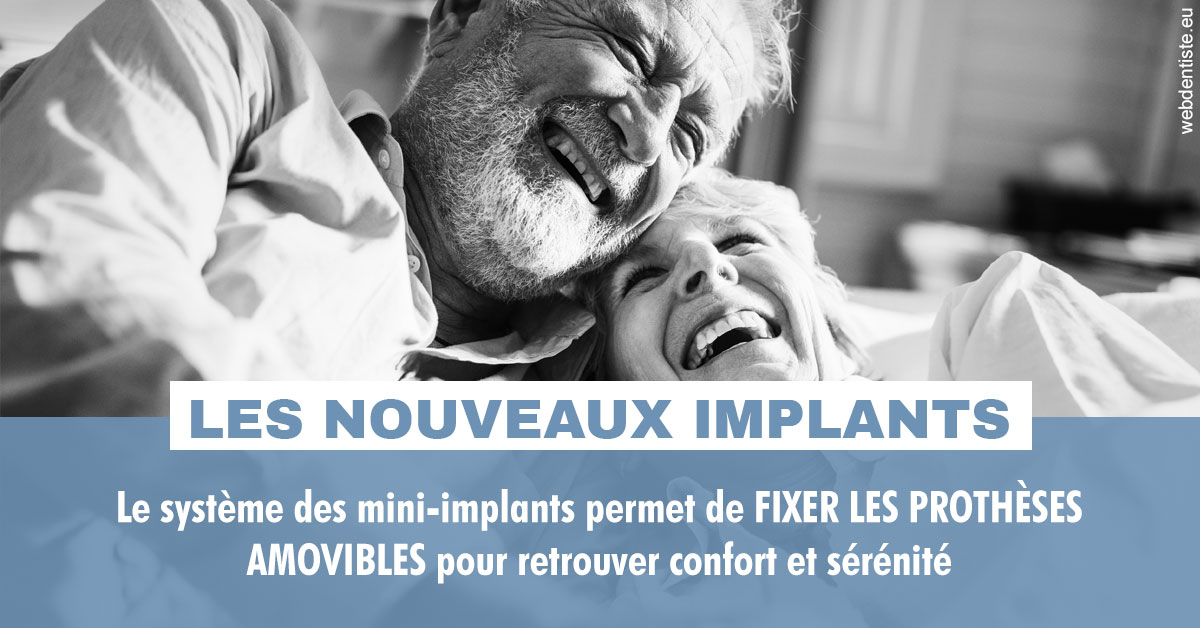 https://dr-becker-michel.chirurgiens-dentistes.fr/Les nouveaux implants 2
