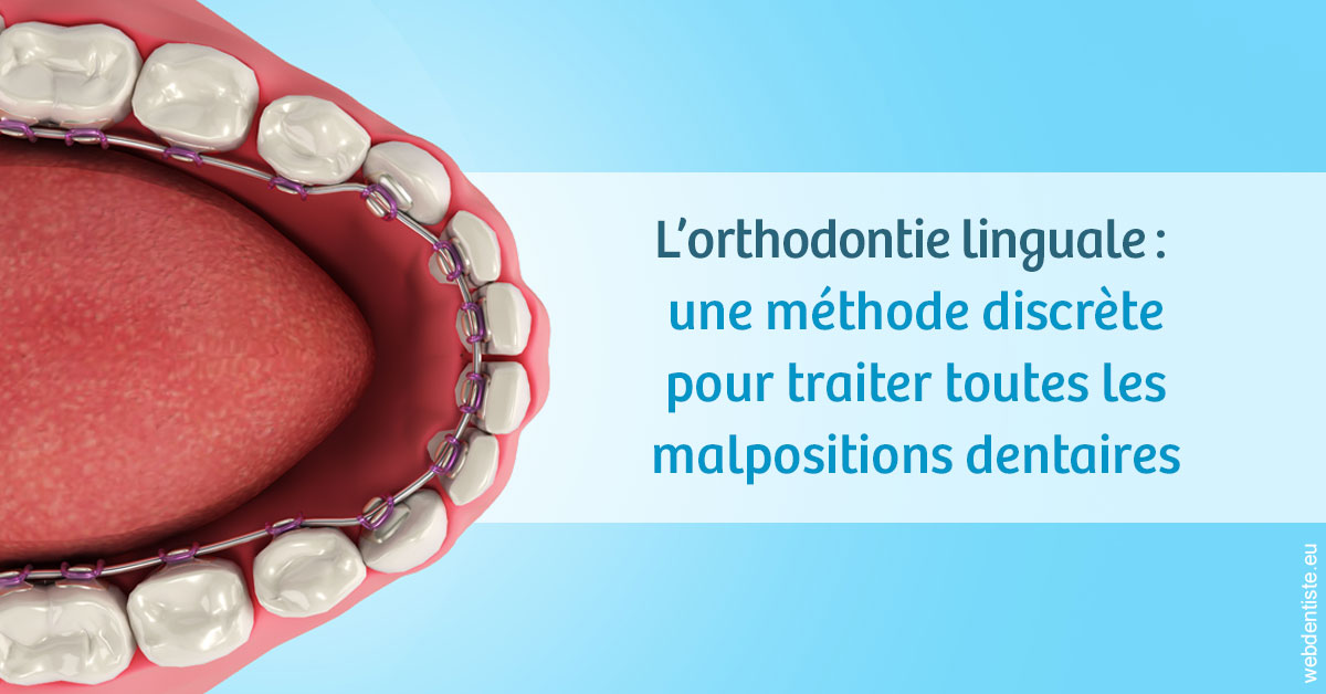 https://dr-becker-michel.chirurgiens-dentistes.fr/L'orthodontie linguale 1