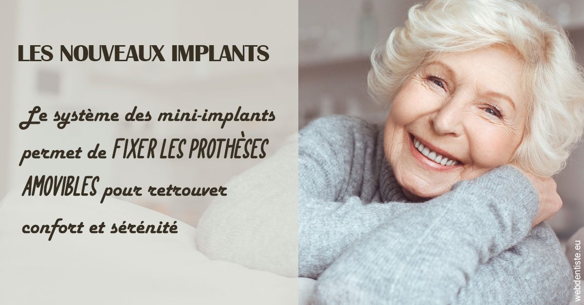 https://dr-becker-michel.chirurgiens-dentistes.fr/Les nouveaux implants 1