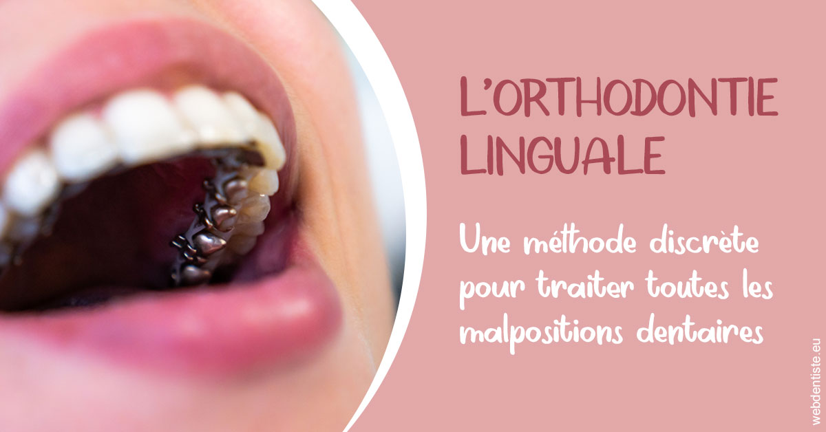 https://dr-becker-michel.chirurgiens-dentistes.fr/L'orthodontie linguale 2
