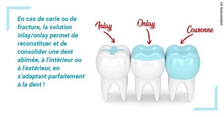 https://dr-becker-michel.chirurgiens-dentistes.fr/L'INLAY ou l'ONLAY