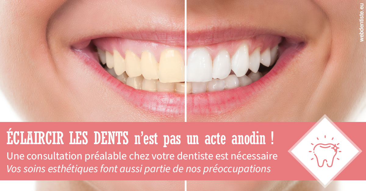 https://dr-becker-michel.chirurgiens-dentistes.fr/Eclaircir les dents 1