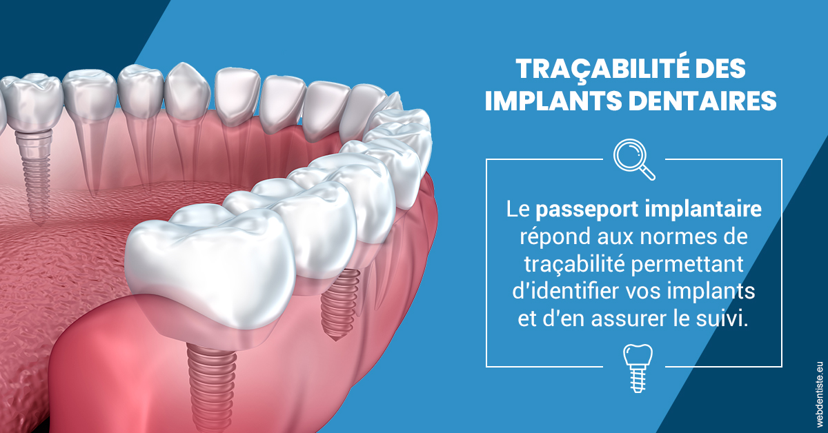 https://dr-becker-michel.chirurgiens-dentistes.fr/T2 2023 - Traçabilité des implants 1