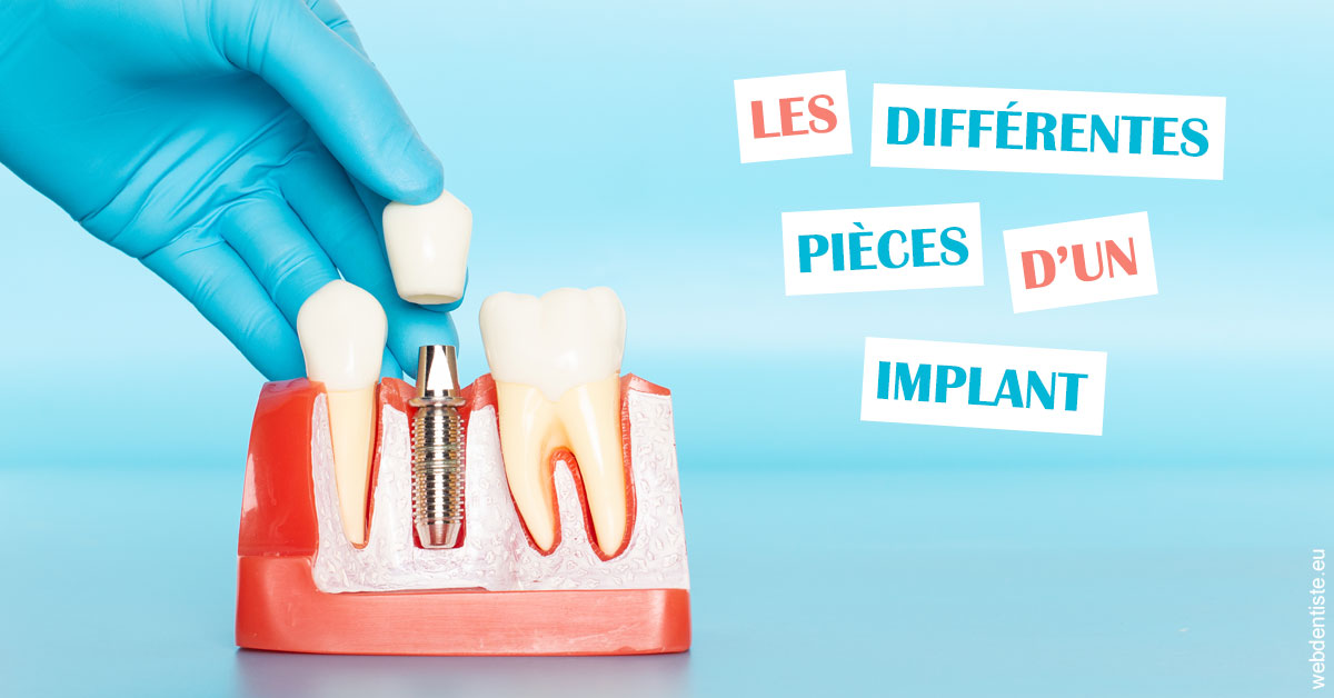 https://dr-becker-michel.chirurgiens-dentistes.fr/Les différentes pièces d’un implant 2
