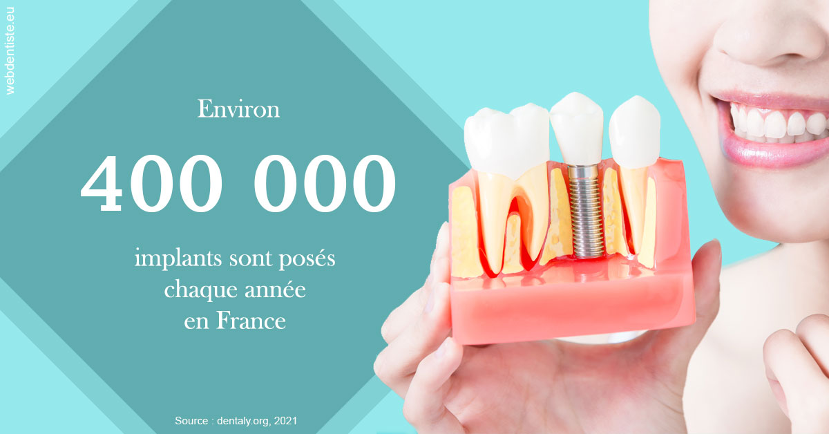 https://dr-becker-michel.chirurgiens-dentistes.fr/Pose d'implants en France 2