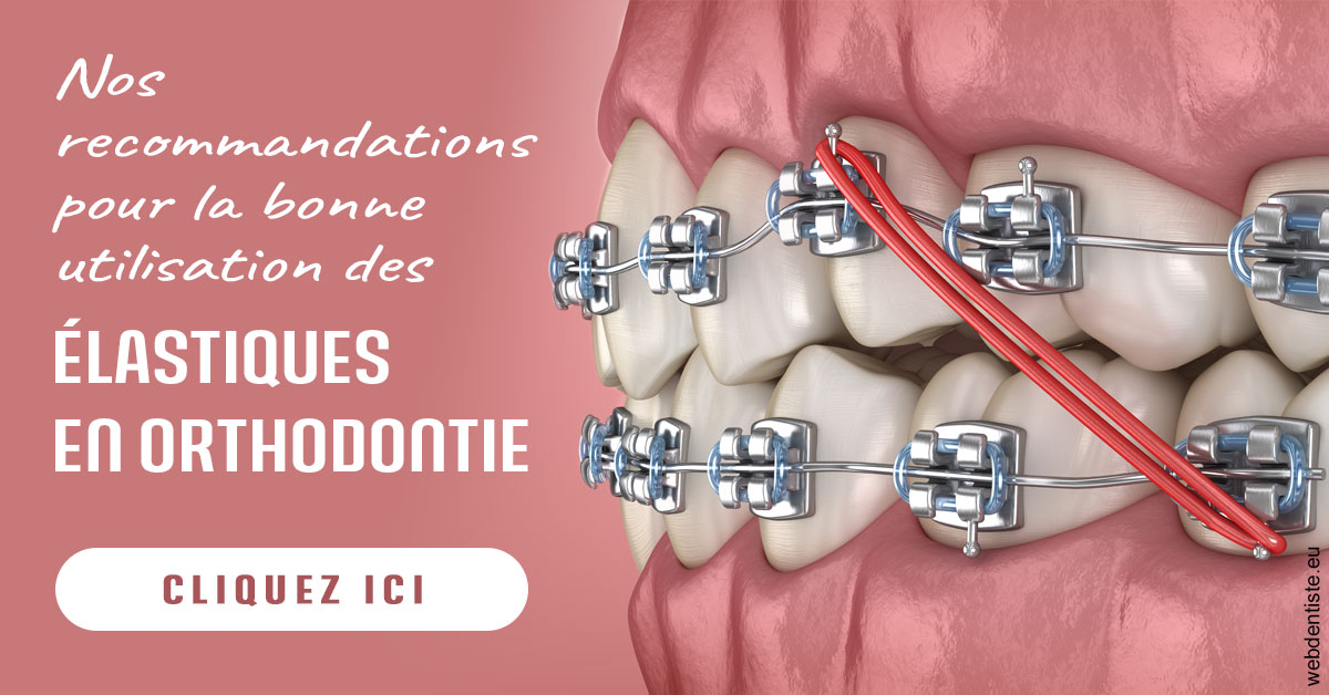 https://dr-becker-michel.chirurgiens-dentistes.fr/Elastiques orthodontie 2